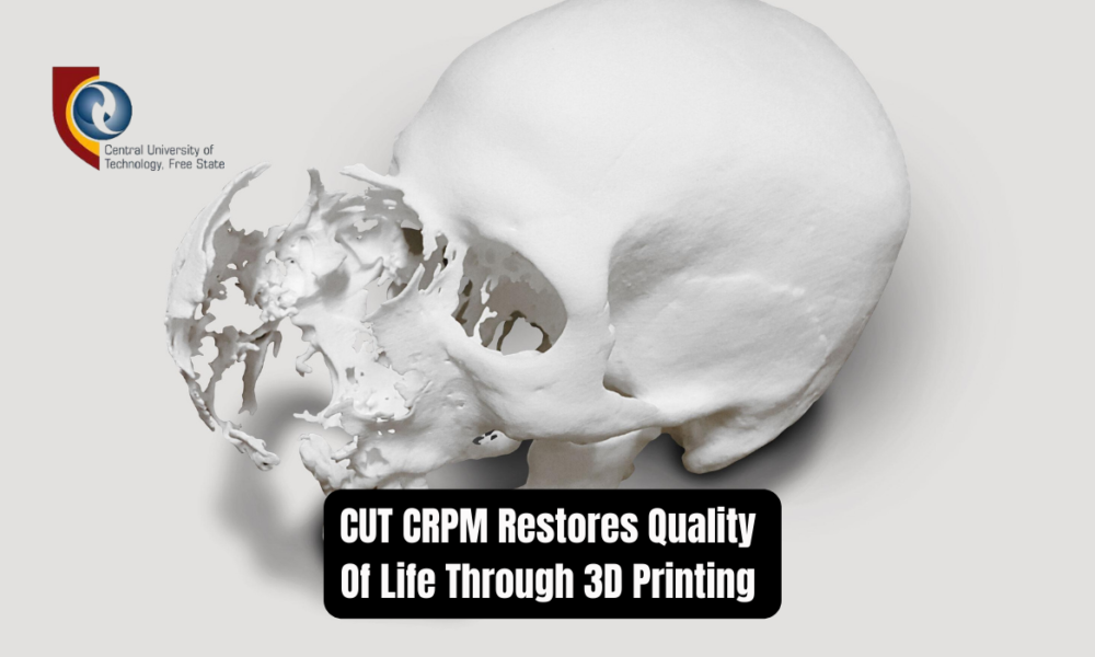 CUT CRPM Restores Quality Of Life Through 3D Printing